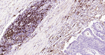 HLA-DR Antibody in Immunohistochemistry (Paraffin) (IHC (P))