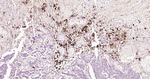 HLA-DR Antibody in Immunohistochemistry (Paraffin) (IHC (P))