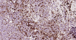 HLA-DR Antibody in Immunohistochemistry (Paraffin) (IHC (P))