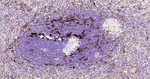HLA-DR Antibody in Immunohistochemistry (Paraffin) (IHC (P))
