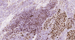 HLA-DR Antibody in Immunohistochemistry (Paraffin) (IHC (P))