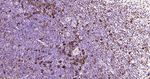 HLA-DR Antibody in Immunohistochemistry (Paraffin) (IHC (P))