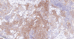GART Antibody in Immunohistochemistry (Paraffin) (IHC (P))