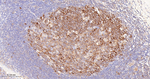GART Antibody in Immunohistochemistry (Paraffin) (IHC (P))
