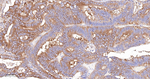 GART Antibody in Immunohistochemistry (Paraffin) (IHC (P))