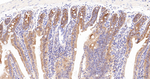 GART Antibody in Immunohistochemistry (Paraffin) (IHC (P))