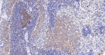GART Antibody in Immunohistochemistry (Paraffin) (IHC (P))