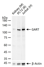 GART Antibody in Western Blot (WB)