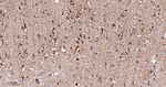 MTCO2 Antibody in Immunohistochemistry (Paraffin) (IHC (P))