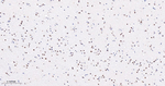 TCF7L2 Antibody in Immunohistochemistry (Paraffin) (IHC (P))
