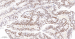 TCF7L2 Recombinant Rabbit Monoclonal Antibody (2C2)