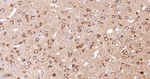 PYK2 Antibody in Immunohistochemistry (Paraffin) (IHC (P))