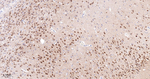 PYK2 Antibody in Immunohistochemistry (Paraffin) (IHC (P))