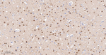 PYK2 Antibody in Immunohistochemistry (Paraffin) (IHC (P))