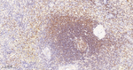 PYK2 Antibody in Immunohistochemistry (Paraffin) (IHC (P))