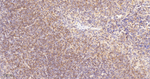 PYK2 Antibody in Immunohistochemistry (Paraffin) (IHC (P))