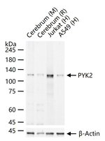 PYK2 Antibody in Western Blot (WB)