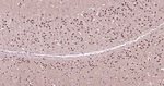 HES1 Antibody in Immunohistochemistry (Paraffin) (IHC (P))