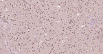 HES1 Antibody in Immunohistochemistry (Paraffin) (IHC (P))