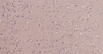 HES1 Antibody in Immunohistochemistry (Paraffin) (IHC (P))