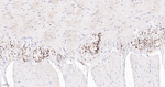 Tyrosine Hydroxylase Antibody in Immunohistochemistry (Paraffin) (IHC (P))