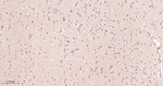 Tyrosine Hydroxylase Antibody in Immunohistochemistry (Paraffin) (IHC (P))