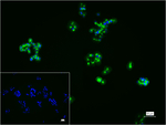 MUC1 Recombinant Rabbit Monoclonal Antibody (5G5)