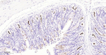 MUC1 Antibody in Immunohistochemistry (Paraffin) (IHC (P))