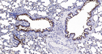 MUC1 Antibody in Immunohistochemistry (Paraffin) (IHC (P))
