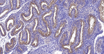 MUC1 Antibody in Immunohistochemistry (Paraffin) (IHC (P))