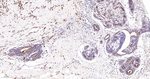 MUC1 Antibody in Immunohistochemistry (Paraffin) (IHC (P))