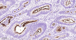 MUC1 Antibody in Immunohistochemistry (Paraffin) (IHC (P))
