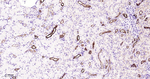 MUC1 Antibody in Immunohistochemistry (Paraffin) (IHC (P))