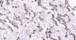 MUC1 Antibody in Immunohistochemistry (Paraffin) (IHC (P))