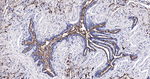 MUC1 Antibody in Immunohistochemistry (Paraffin) (IHC (P))