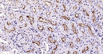 ACE2 Recombinant Rabbit Monoclonal Antibody (3F1)