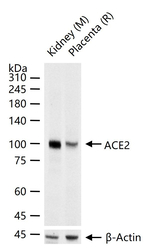 ACE2 Antibody in Western Blot (WB)