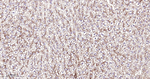 CD13 Antibody in Immunohistochemistry (Paraffin) (IHC (P))