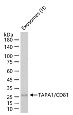 CD81 Antibody in Western Blot (WB)