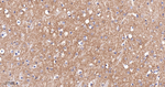 mGluR1 Antibody in Immunohistochemistry (Paraffin) (IHC (P))