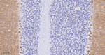 mGluR1 Antibody in Immunohistochemistry (Paraffin) (IHC (P))