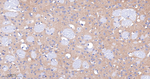 mGluR1 Antibody in Immunohistochemistry (Paraffin) (IHC (P))