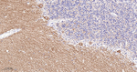 mGluR1 Antibody in Immunohistochemistry (Paraffin) (IHC (P))