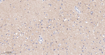 mGluR1 Antibody in Immunohistochemistry (Paraffin) (IHC (P))