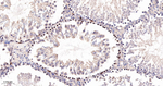 Cyclin A2 Antibody in Immunohistochemistry (Paraffin) (IHC (P))