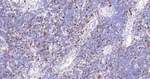 Cyclin A2 Antibody in Immunohistochemistry (Paraffin) (IHC (P))