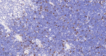 Cyclin A2 Antibody in Immunohistochemistry (Paraffin) (IHC (P))