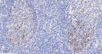 Cyclin A2 Antibody in Immunohistochemistry (Paraffin) (IHC (P))