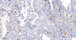 Cyclin A2 Antibody in Immunohistochemistry (Paraffin) (IHC (P))