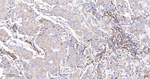 Cyclin A2 Antibody in Immunohistochemistry (Paraffin) (IHC (P))